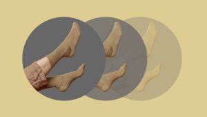 Steps to Treating Restless Legs Syndrome